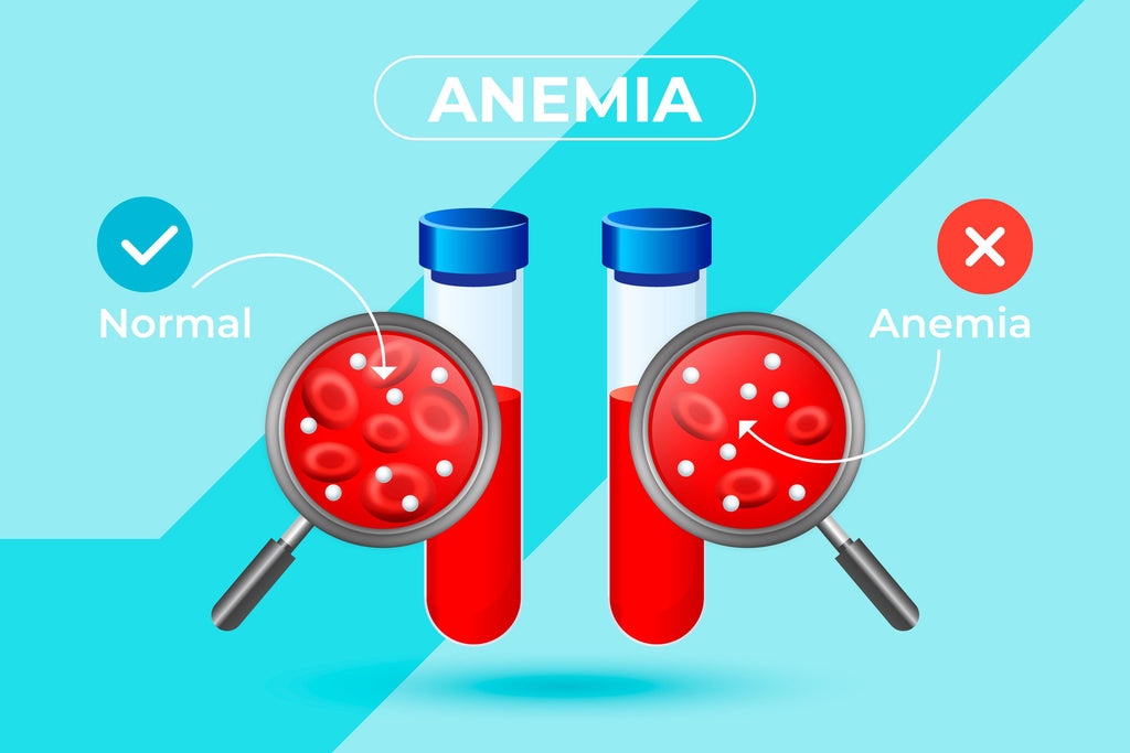 Recipe Ideas To Combat Anemia
